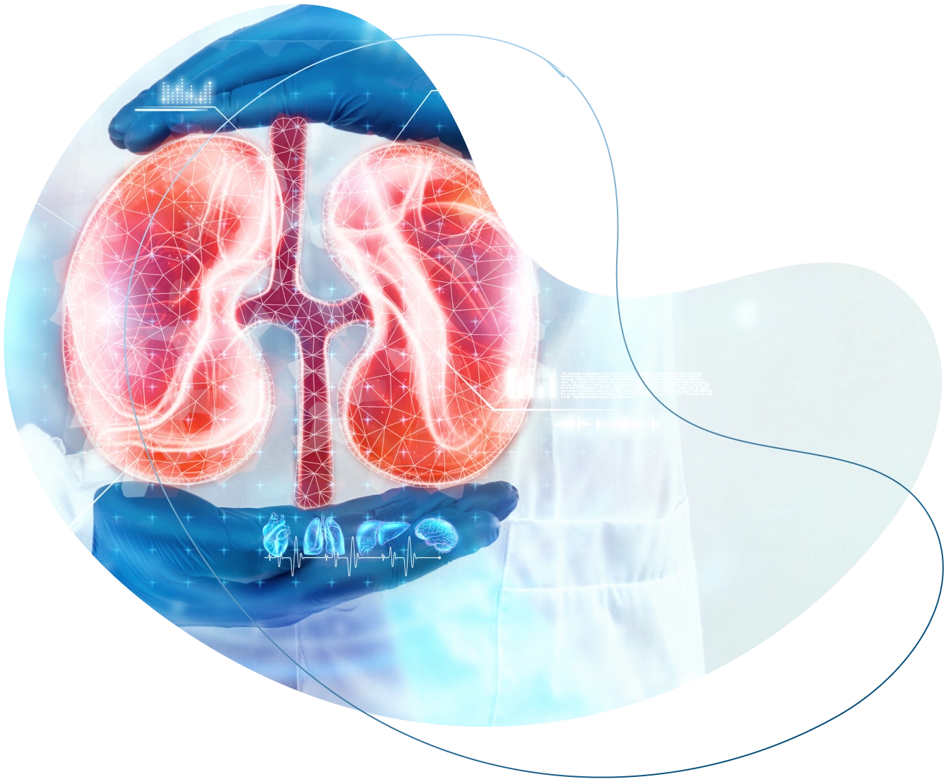 Kidney Assistance